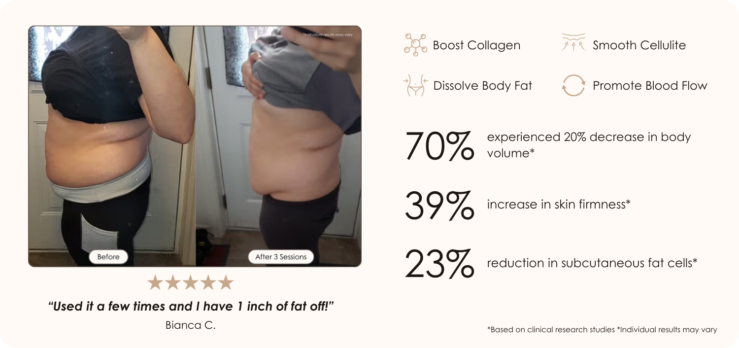 BodySculpt LED Radio frequency before and after results showing tighter slimmer abdomen